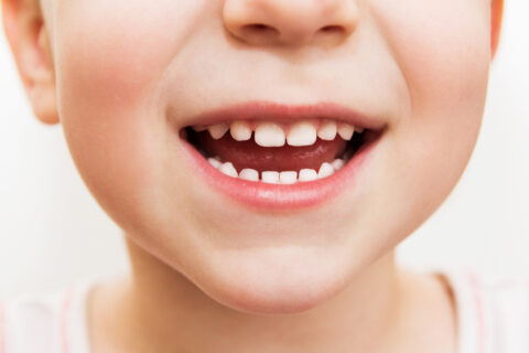 Baby's Teeth Can Be Ruined by Pacifiers | Dr Nick Addario